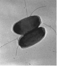 Bild1. Elektronenmikroskopische Aufnahme von zwei Zellen des Bakterium Ralstonia metallidurans