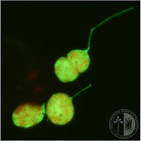 Stromules of transgenic N. benthamiana plants.